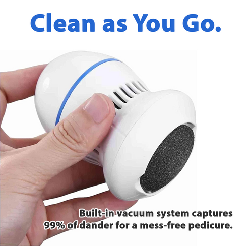 Daphtora® Vacuum Callus Remover